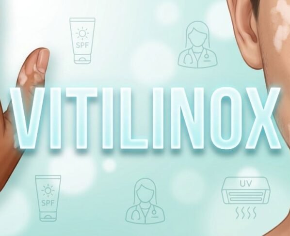 Vitilinox: Safe Guide for White Skin Patches & Care